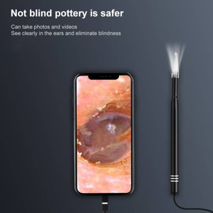 3-in-1-Smart-HD-5,5-mm-Objektiv, visueller Earpick, nicht kompatibel mit einigen Telefonen – Bild 5
