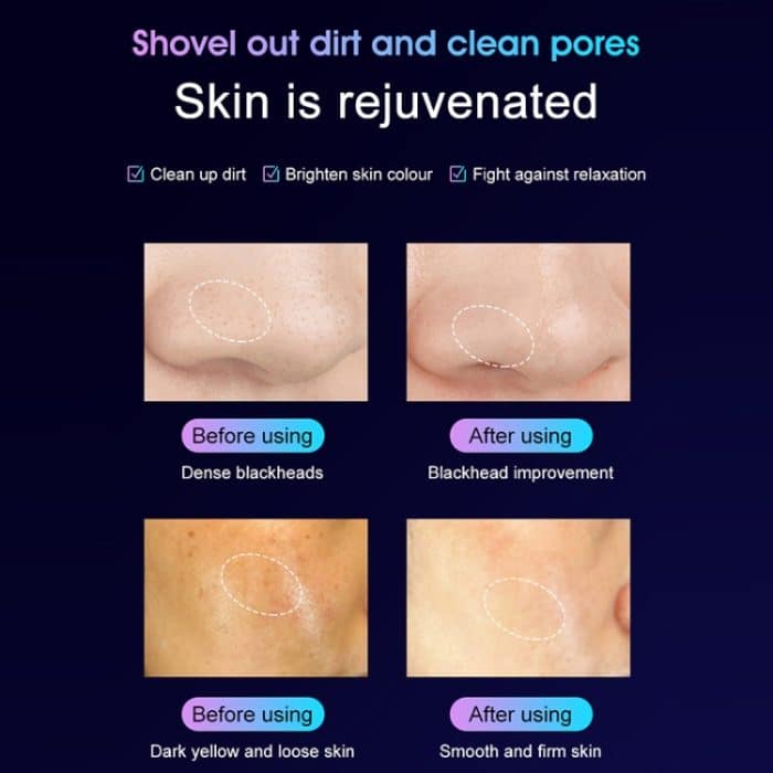 YJK028 3,7 V 250 mAh Ultraschall-Ionenreinigungsgerät der zweiten Generation, JK028(White) – Bild 5