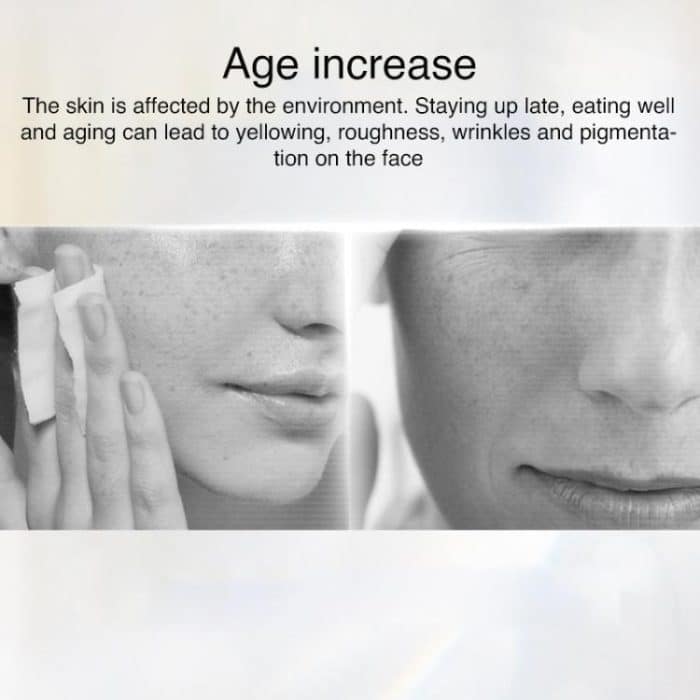 WG-M01 Milk Light Skin Rejuvenation Beauty Device Home Portable Photon Beauty Instrument, EU Plug, US Plug, UK Plug – Bild 4