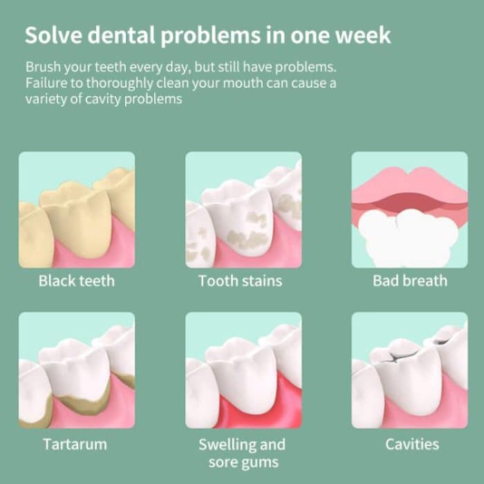 FY-B301 Portable Folding Smart Water Flosser, 120ml Water Tank, FY-B301 – Bild 5