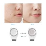 YJK059 Multifunktionales Farblicht-Einführungsinstrument Negativionen-Schönheitsinstrument, YJK059(White) – Bild 4