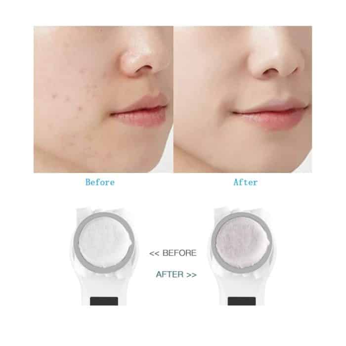 YJK059 Multifunktionales Farblicht-Einführungsinstrument Negativionen-Schönheitsinstrument, YJK059(White) – Bild 4