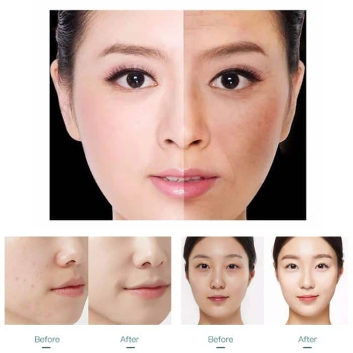 YJK059 Multifunktionales Farblicht-Einführungsinstrument Negativionen-Schönheitsinstrument, YJK059(White) – Bild 7