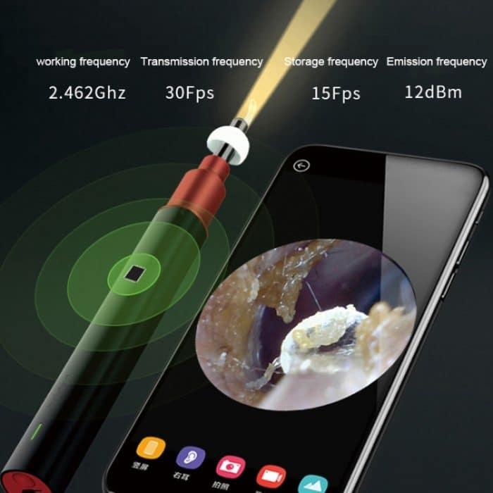 Bebird B1 Intelligentes visuelles HD-Ohrreiniger-Ohrenschmalz-Werkzeug, Standardversion, Standard Version – Bild 9