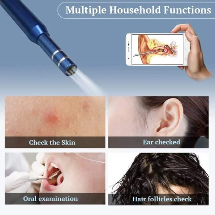 i95 3-in-1-USB-Ohrfernrohr-Inspektion, HD-0,3-MP-Kamera, visueller Ohrlöffel für OTG-Android-Telefone, PC und MacBook, 1,75 m langes Kabel, 3 in 1 White  0.3MP – Bild 11