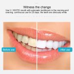 Weiß 3 Reinigungsmodi Elektrisches automatisches Schönheitszahninstrument aus Silikon – Bild 13