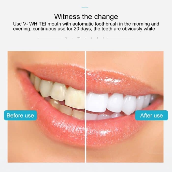 Weiß 3 Reinigungsmodi Elektrisches automatisches Schönheitszahninstrument aus Silikon – Bild 13