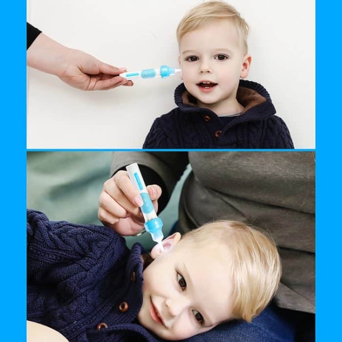 Ohrenreiniger Kinder Gleamy Elektrisches, sanftes und effektives Ohrenreinigungsgerät, Ear-cleaner – Bild 11