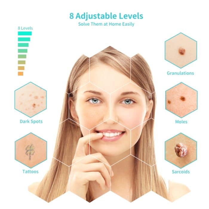 Xpreen XPRE061 Professioneller Entferner für dunkle Flecken, Sommersprossentätowierung, aufladbarer Warzen- und Muttermalentferner, mit LED-Bildschirm und Scheinwerfer – Bild 3