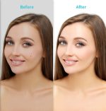 Xpreen XPRE061 Professioneller Entferner für dunkle Flecken, Sommersprossentätowierung, aufladbarer Warzen- und Muttermalentferner, mit LED-Bildschirm und Scheinwerfer – Bild 6