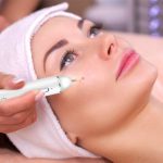 Xpreen XPRE061 Professioneller Entferner für dunkle Flecken, Sommersprossentätowierung, aufladbarer Warzen- und Muttermalentferner, mit LED-Bildschirm und Scheinwerfer – Bild 10