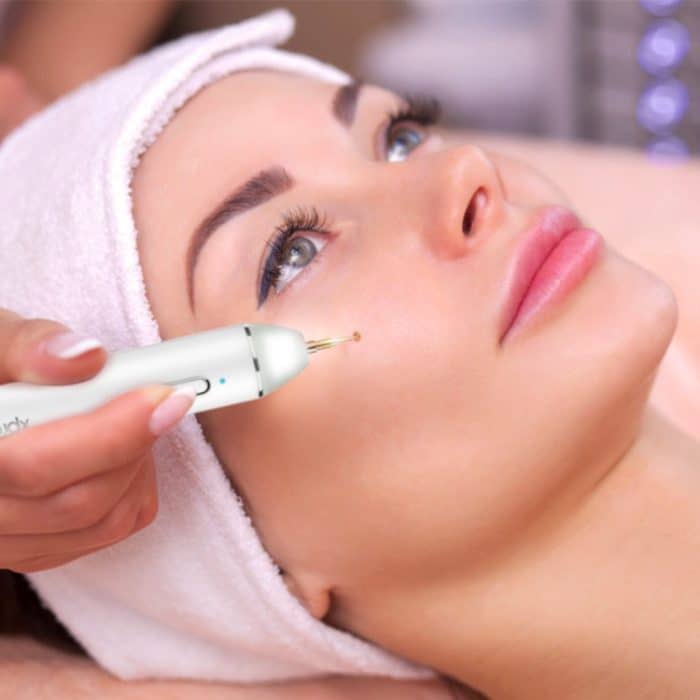 Xpreen XPRE061 Professioneller Entferner für dunkle Flecken, Sommersprossentätowierung, aufladbarer Warzen- und Muttermalentferner, mit LED-Bildschirm und Scheinwerfer – Bild 10