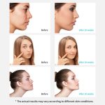 Xpreen wiederaufladbare Porenreiniger Home Facial Beauty Device mit LED-Bildschirm und 4 Sonden – Bild 11