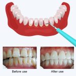 LSHOW YJK015A 3,7 V USB-Aufladung Fünf-Gang-Modus Wasserdichter elektrischer Hochfrequenz-Vibrations-Zahnpolierer für den Haushalt – Bild 6