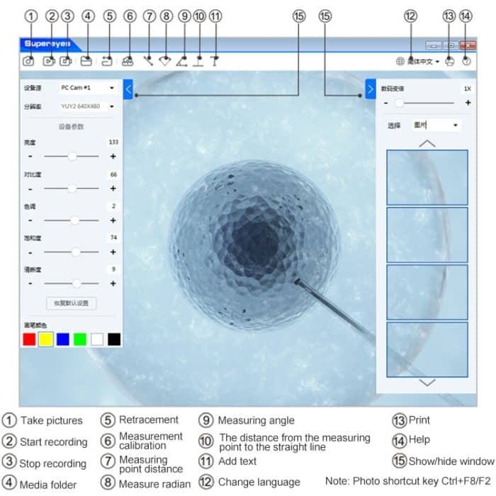 Supereyes Y008P Haustierohrnase-Mund-drahtloses digitales elektronisches Endoskop – Bild 7
