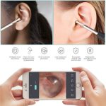 W1 Smart WiFi Ear Pick Reinigungsset Werkzeug zum Entfernen von Ohrenschmalz mit LED-Licht, W1 – Bild 3