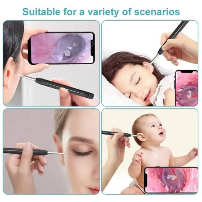 W1 Smart WiFi Ear Pick Reinigungsset Werkzeug zum Entfernen von Ohrenschmalz mit LED-Licht, W1 – Bild 5