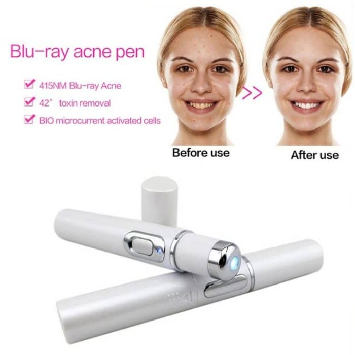 K-SKIN KD-7910 Akne-Laserstift Tragbare Faltenentfernungsmaschine Langlebiges Gerät zur Entfernung weicher Narben Blaulicht-Therapiestift – Bild 6