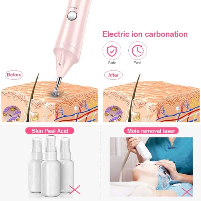 K-SKIN KD306 Laser-Spotting-Maschine, Plasma-Stift, dunkler Wimpernentferner für die Entfernung von Gesichtskrämpfen, Tattoo-Hautpflege, White, Pink – Bild 5