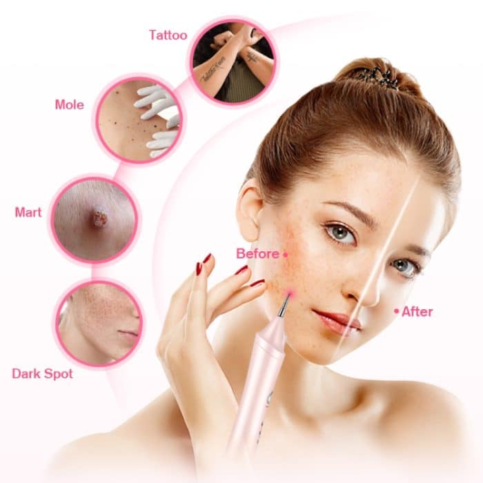 K-SKIN KD306 Laser-Spotting-Maschine, Plasma-Stift, dunkler Wimpernentferner für die Entfernung von Gesichtskrämpfen, Tattoo-Hautpflege, White, Pink – Bild 6