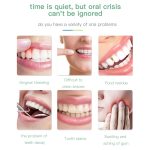 Drahtloser Wasser Flossreiniger tragbar 1400mAh USB-wiederaufladbarer Wasser-Flosser IPX7 wasserdichter Oralwarler, Wassertank-Kapazität: 300ml – Bild 4