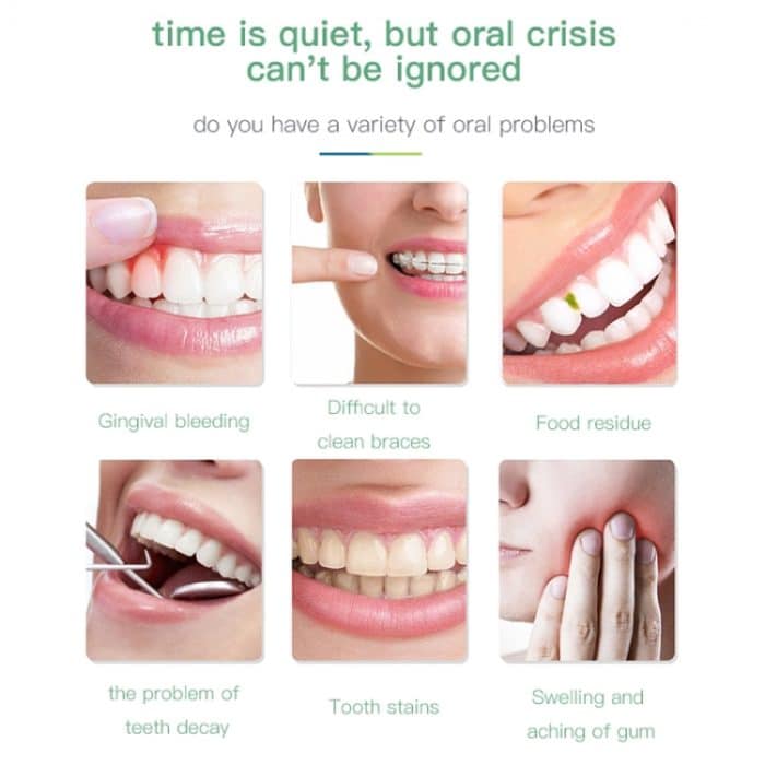 Drahtloser Wasser Flossreiniger tragbar 1400mAh USB-wiederaufladbarer Wasser-Flosser IPX7 wasserdichter Oralwarler, Wassertank-Kapazität: 300ml – Bild 4