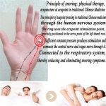 Akupressur-Anti-Schnarch-Ring-Behandlung, Reflexzonenmassage, Anti-Schnarch-Apnoe-Schlafgerät – Bild 7