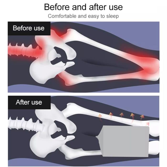 Orthopädisches Memory-Schaum-Kniekeilkissen zum Schlafen, Ischias, Rücken, Hüfte, Gelenk, Schmerzlinderung, Kontur, Oberschenkel, Beinpolster, Stützkissen, White, Grey grid, Navy Blue grid, White+bandage, Grey grid+bandage, Navy blue grid+bandage... – Bild 4