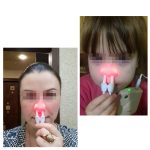 BIONASE Nasenpflege-Therapiegerät, Rhinitis-Sinusitis-Heilung, Heuschnupfen-Behandlungsgerät – Bild 2