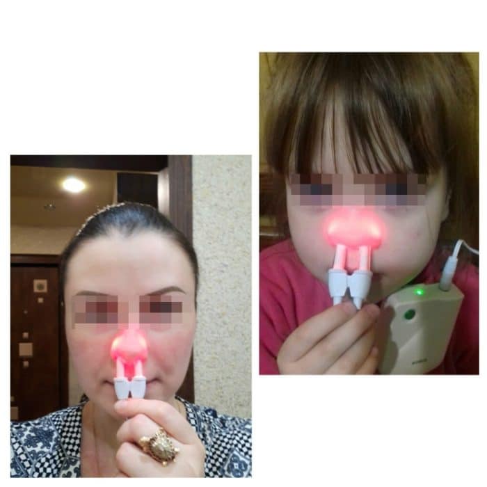 BIONASE Nasenpflege-Therapiegerät, Rhinitis-Sinusitis-Heilung, Heuschnupfen-Behandlungsgerät – Bild 2