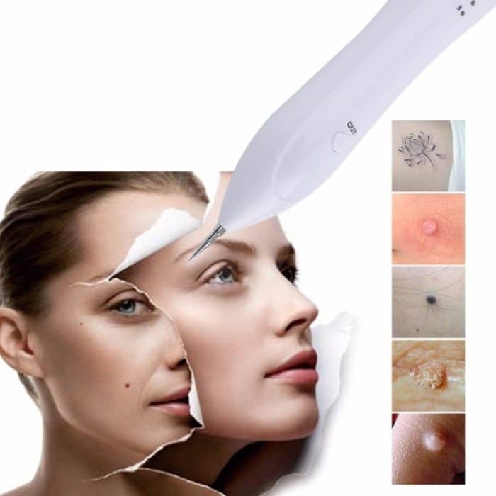 Dunkelfleckentferner USB Laser Plasma Pen Gesichts Sommersprossen Warzenentfernung Beauty Care Device – Bild 10