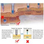 Kleine Stahlkanone Zerstäuber Nadelloses Schönheitsgerät – Bild 10