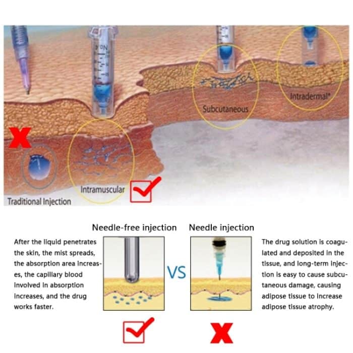 Kleine Stahlkanone Zerstäuber Nadelloses Schönheitsgerät – Bild 10