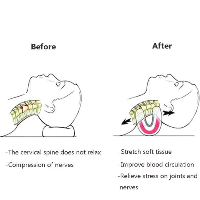 Halswirbelsäulenkissen, Dehnungsmassagegerät, Orthese, tragbares Nackenkissen – Bild 4
