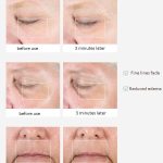 2-teiliges Augen- und Lippenmassagegerät zum Verdünnen der Tränensäcke ohne Batterie – Bild 6