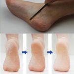 Pediküre Maniküre Nagelreiniger Nagelhautpflege Dead Skin Planer Beauty Fußpflege-Tool – Bild 2