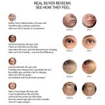 Radio Mesotherapie Elektroporation Gesicht Schönheit Stift Radio Frequenz LED Photon Gesicht Haut Verjüngung Entferner Falten – Bild 10