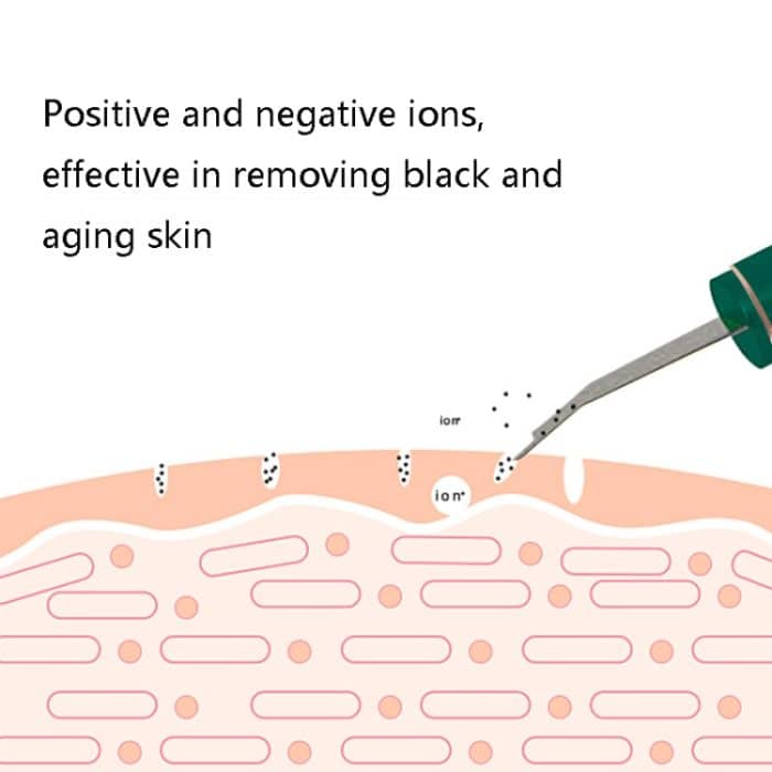 Elektrisches Ultraschall-Gesichtsreinigungsinstrument, Mitesser-Instrument – Bild 3