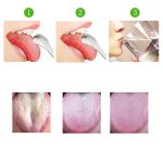 2 Stück Zungenreiniger Mundgeruch Edelstahl-Reinigungsbürste, Tongue Scraper+Two-piece Set (Silver ), Tongue Scraper + Two-piece Set (Rose Gold ) – Bild 5