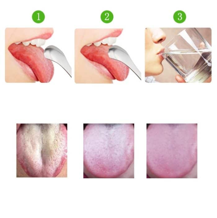 2 Stück Zungenreiniger Mundgeruch Edelstahl-Reinigungsbürste, Tongue Scraper+Two-piece Set (Silver ), Tongue Scraper + Two-piece Set (Rose Gold ) – Bild 5