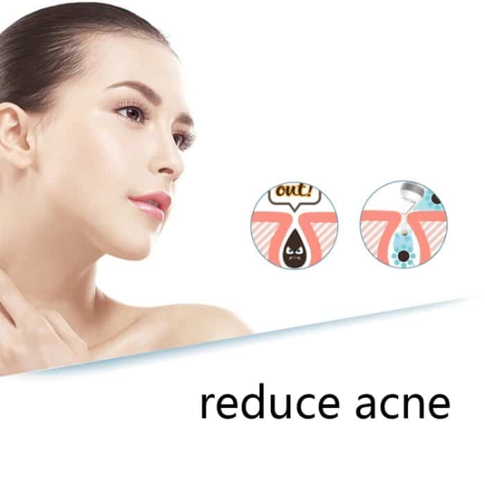 QY208 Gesichtsreinigungs-Mitesser-Porenreiniger – Bild 5