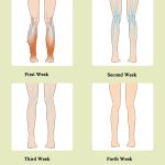 Beinmassagegerät, Waden-Luftwellen-Massagegerät, Haushalts-Krampfader-Physiotherapiegerät, Ordinary Type, Upgrade Fever Type – Bild 5