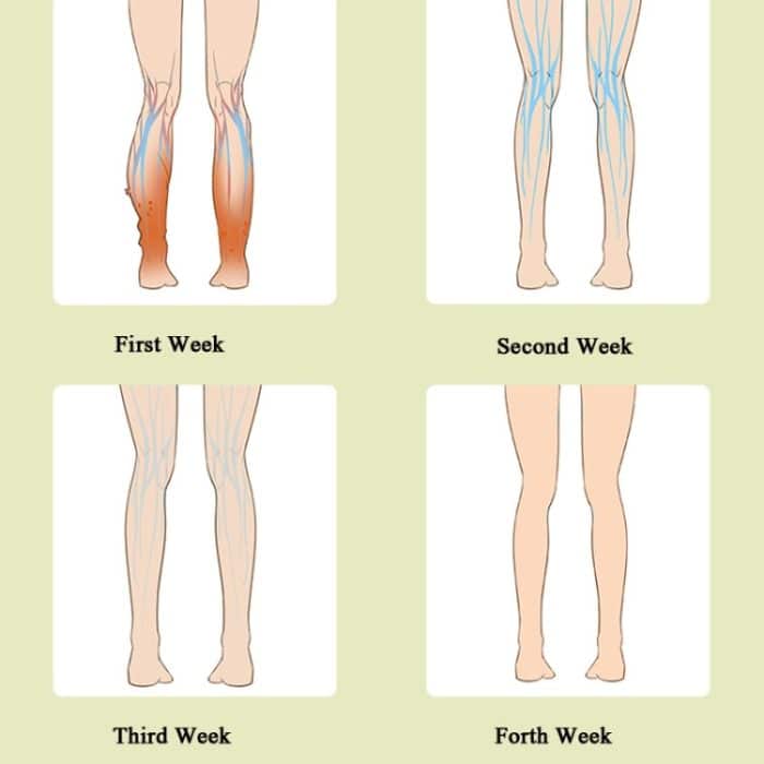 Beinmassagegerät, Waden-Luftwellen-Massagegerät, Haushalts-Krampfader-Physiotherapiegerät, Ordinary Type, Upgrade Fever Type – Bild 5