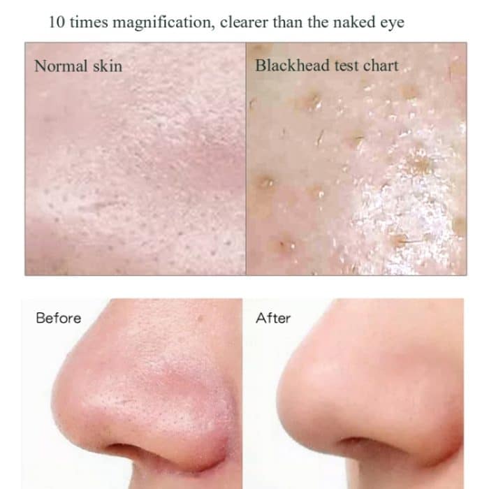 Elektrische Mitesser-Porenentfernungsmaschine, saubere Gesichtsausrüstung, Stil:, Visual Model, Base Model, Without Base – Bild 5