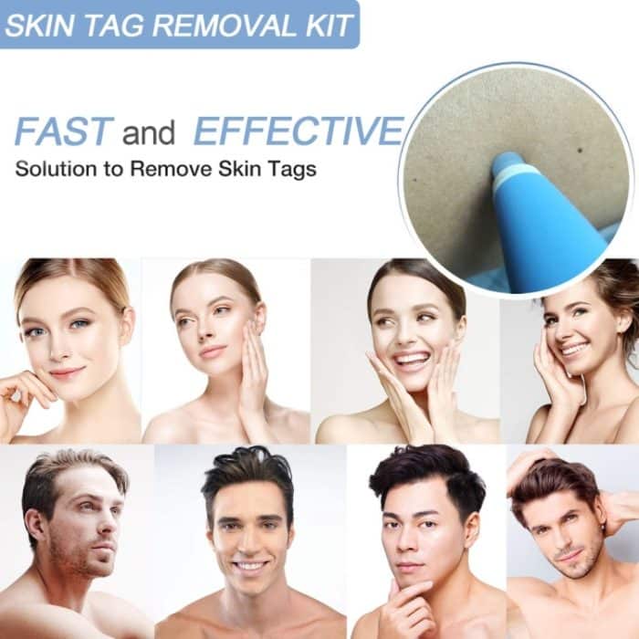 Werkzeug zum Entfernen von Hautmarkierungen für 2 mm bis 4 mm große Hautmarkierungen, Skin Tag Removal Tool, With  Acne Patch – Bild 6