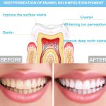 Drahtgesteuertes 25-Minuten-Timing-16LED-Zahnaufhellungsgerät Zahnbleaching-System, Wire-Controlled – Bild 5