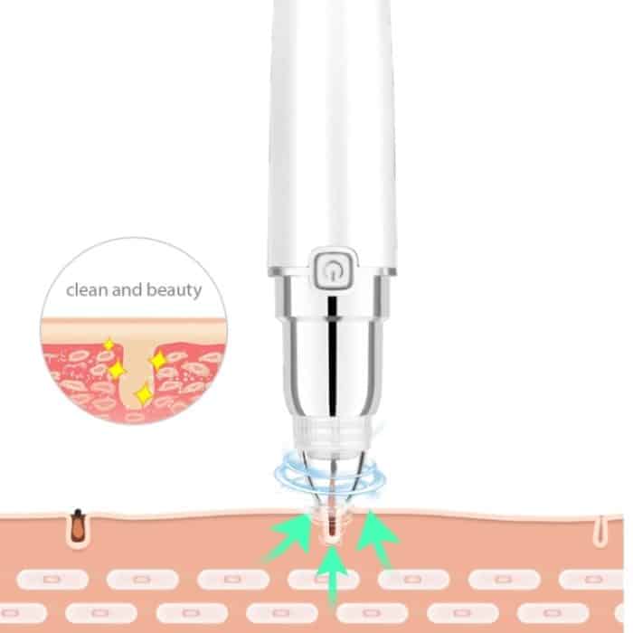 HD-3138 Elektrisches Porenreinigungsinstrument, heiße Kompresse zum Exportieren von Akne, entfernendes Mitesser-Schönheitsinstrument, White With Acne Needle – Bild 6