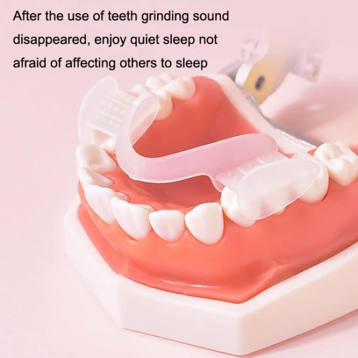 Y-Kelin Kieferorthopädische Apparatur, Silikon-Simulationsspangen, Anti-Molaren-Zahnspange für die Nacht, Transparent – Bild 4