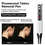 AA-A401 Kleiner Stift zur Entfernung von Sommersprossen und Muttermalen, Tattoo- und Augenbrauenentfernungs-Schönheitsinstrument, Red Light Plug-in, Blu-ray Plug-in, Red Light Battery, Blu-ray Battery – Bild 8