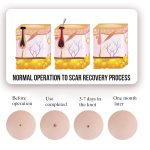 FY-106 Tragbarer Stift zur Entfernung von Muttermalen und Sommersprossen Haushaltslaser-Schönheitsgerät, FY-106 (Rose Gold), FY-106 (Gold), FY-106 (Green), FY-106 (Blue) – Bild 4